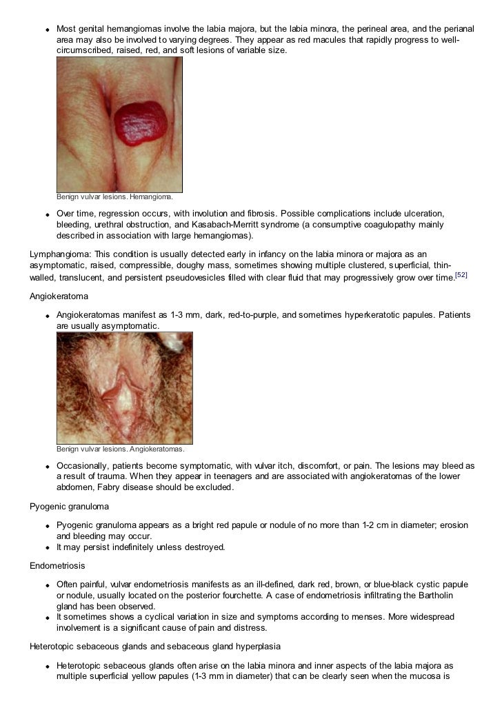 vulva red lesion Vulva red lesion